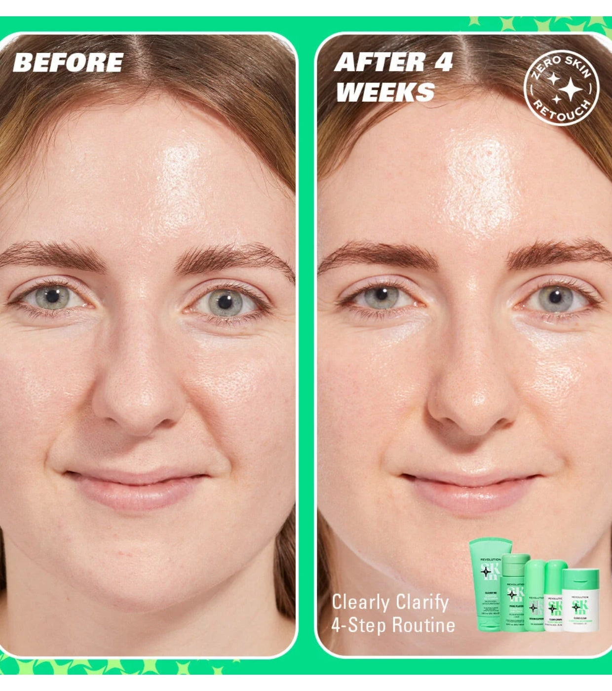 Revolution Skin - *Clearly Clarify* - Siero viso chiarificante Clear Canvas