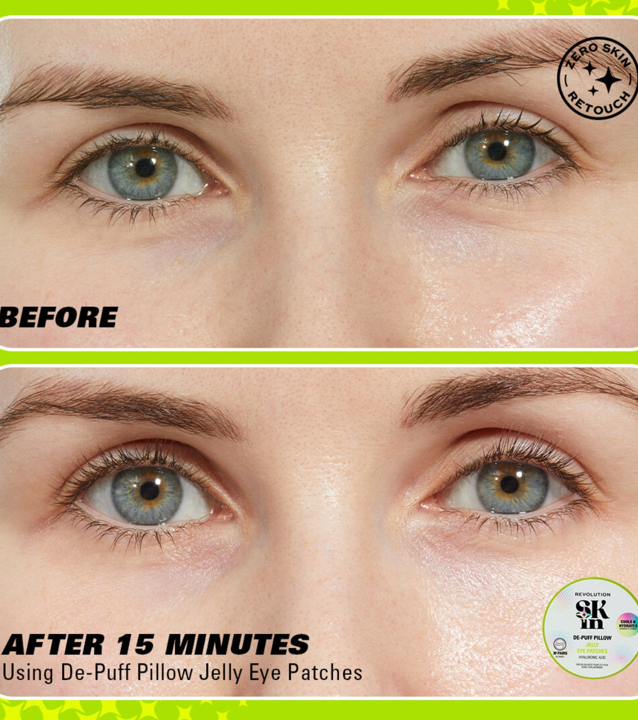 Revolution Skin - Bende per gli occhi Jelly De-Puff Pillow